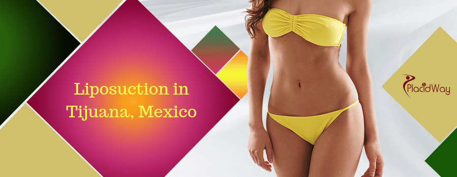 Liposuction in Tijuana, Mexico